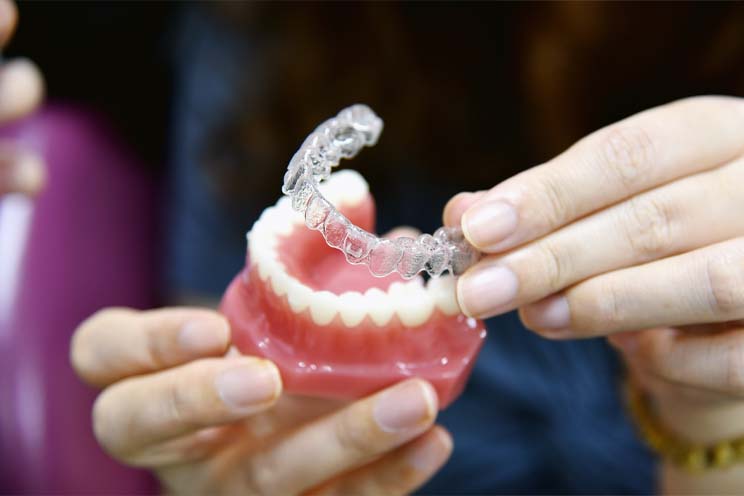 ortodoncia invisible en Avilés. Invisalign Clínica Suárez Solís