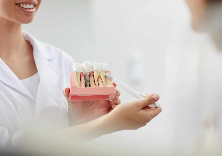 Ortodoncia e implantes dentales - Resolvemos tus dudas - Especialistas en Ortodoncia en Avilés- Suárez Solís.jpg
