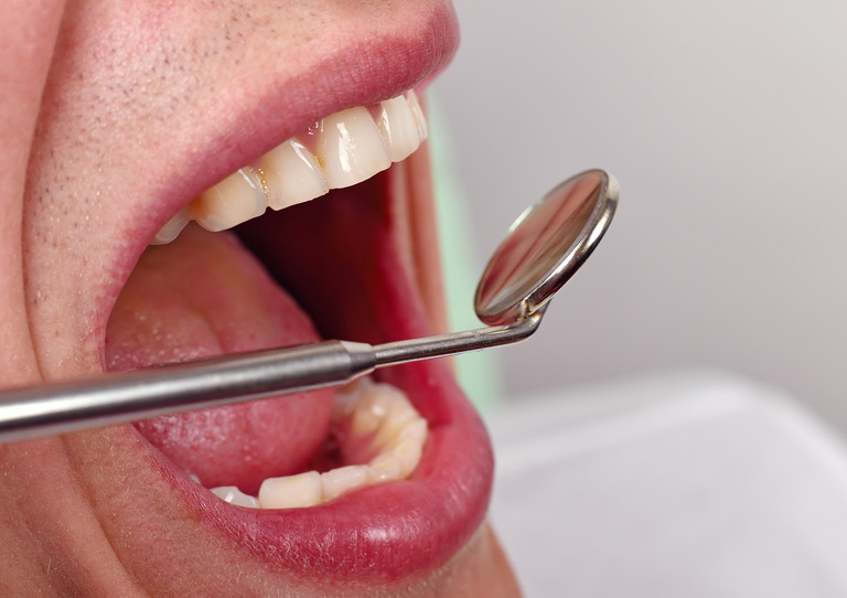 Cuáles son los síntomas de un flemón y cómo tratarlos - Clínica dental en Avilés