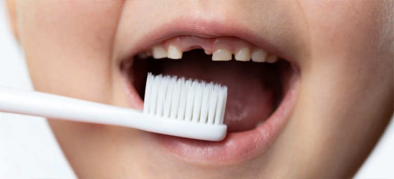 Odontopediatría, esencial para unos dientes sanos - Suárez Solís, Odontopediatría en Avilés
