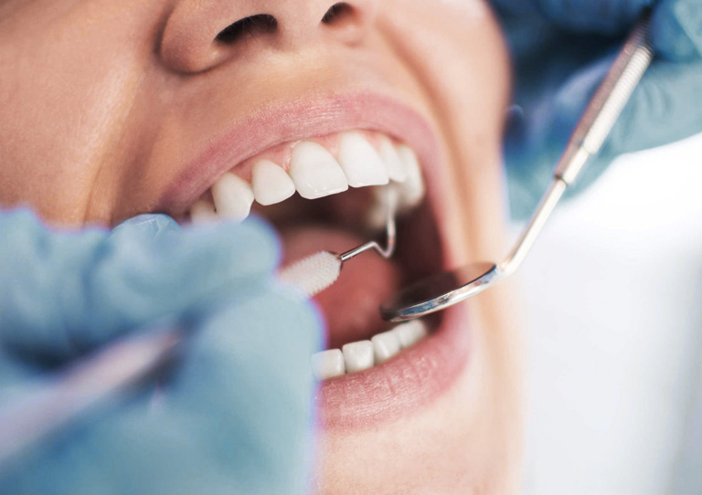 Ortodoncia multidisciplinar para rehabilitación dental -Suárez Solís - Ortodoncia en Avilés