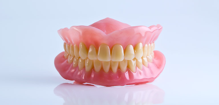dentadura postiza antes de ser entregada a un paciente en nuestra clínica dental en Avilés. La mejor alternativa son los implantes dentales.
