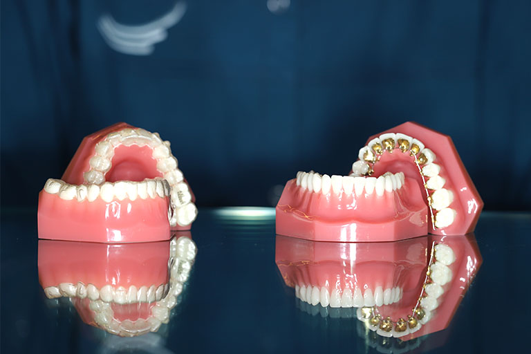 Clínica Dental Suarez Solís. Invisalign es el tratamiento de ortodoncia más buscado