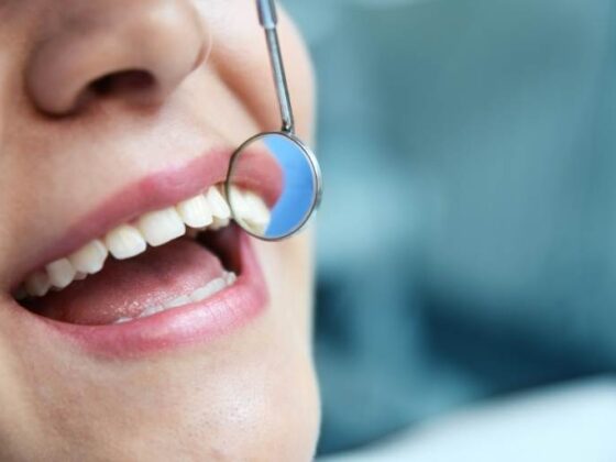 prepararse mentalmente para un implante dental