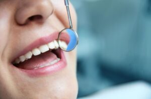 Cómo y por qué se pueden extraer los premolares