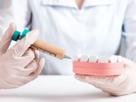6 Cosas sobre la Anestesia Dental que deberías conocer
