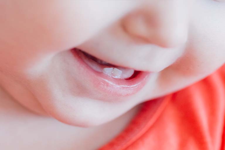 ¿Cómo aliviar las molestias de la dentición de los niños?
