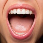 ¿Qué significa la lengua blanca?