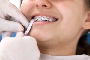 La IA se introduce en tratamientos de ortodoncia