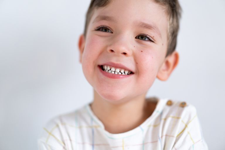 El impacto de la crianza sobreprotectora en la salud oral de los niños.