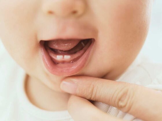 10 cosas que no sabes de los dientes de tu bebe