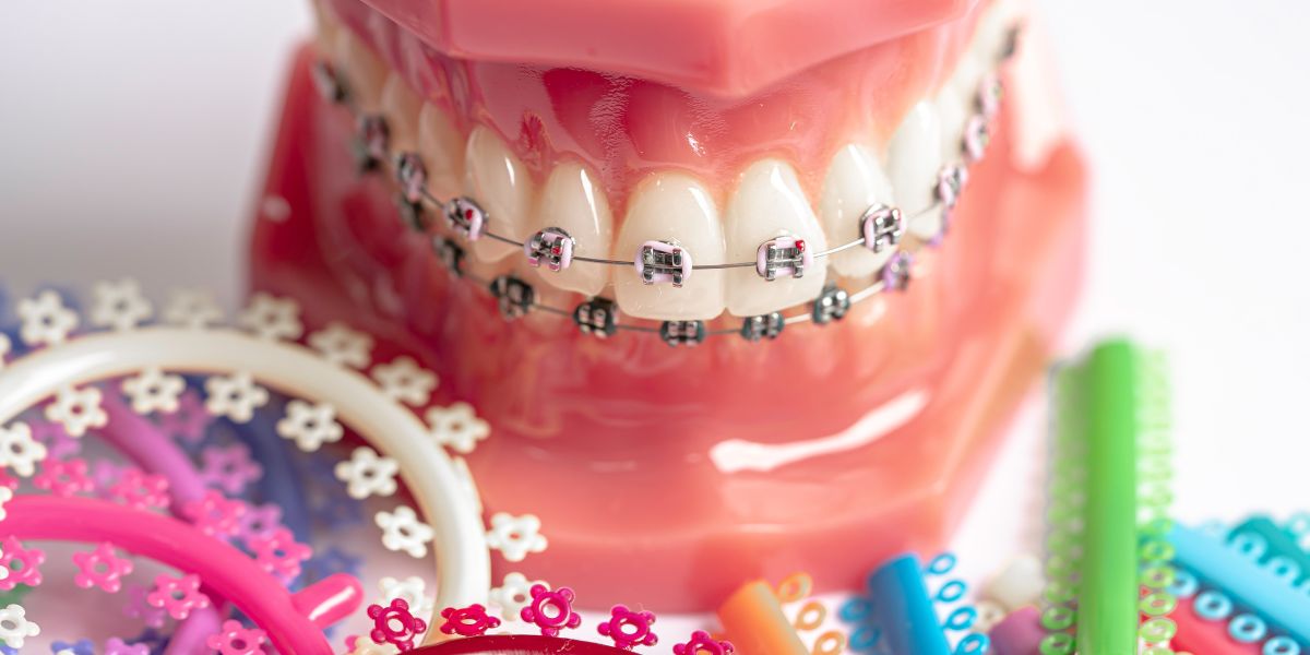 Los tratamientos tempranos de ortodoncia ofrecen una base sólida para una sonrisa saludable y alineada en el futuro, destacando la importancia de una intervención proactiva en la infancia.