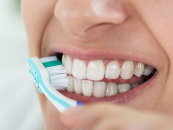 Caries Interproximales - Dentista en Avilés - Clínica Dental Suarez Solis