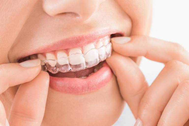 Puede la ortodoncia mejorar los problemas de habla -Clínica Suarez Solis - Dentista en Avilés