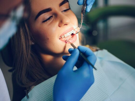 ¿dañan los aparatos de ortodoncia tus dientes? Clínica Suarez Solís