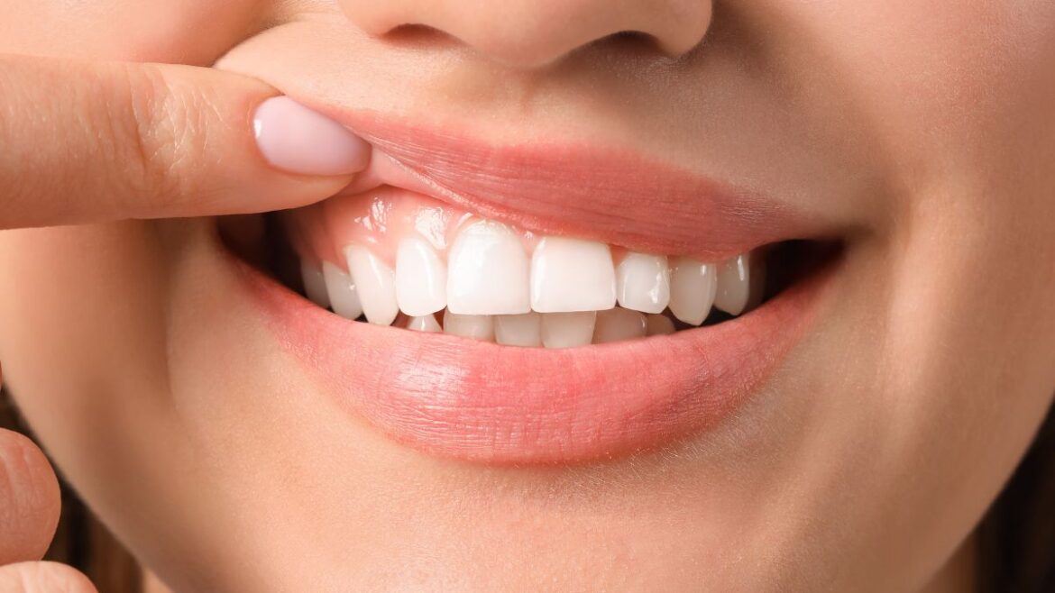 Desgaste dental patológico causas y tratamiento - Clinica Dental Suarez Solis - Clinica dental en Avilés