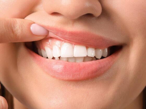 Desgaste dental patológico causas y tratamiento - Clinica Dental Suarez Solis - Clinica dental en Avilés