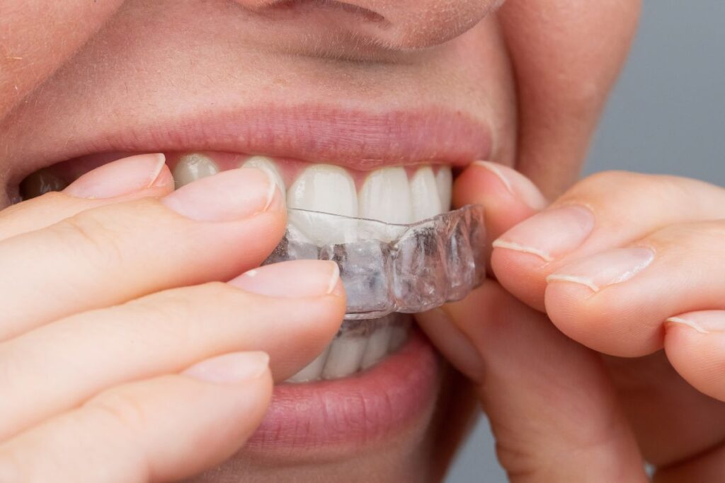 Implantes dentales y ortodoncia. Suárez Solís. Dentista Avilés.