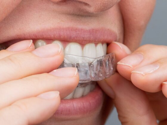 Implantes dentales y ortodoncia. Suárez Solís. Dentista Avilés.